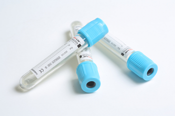 ПРОБИРКИ AMPULAB ВАКУУМНЫЕ, ЦИТРАТ НАТРИЯ 3,8%, 4.5 МЛ, 13?100 ММ, УП. 100 ШТ., 304212