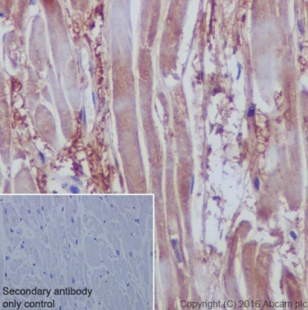 АНТИТЕЛА МОНОКЛОНАЛЬНЫЕ КРОЛИЧЬИ RECOMBINANT ANTI-VEGFD [EPR8457], 100 МКЛ, ABCAM, AB155288
