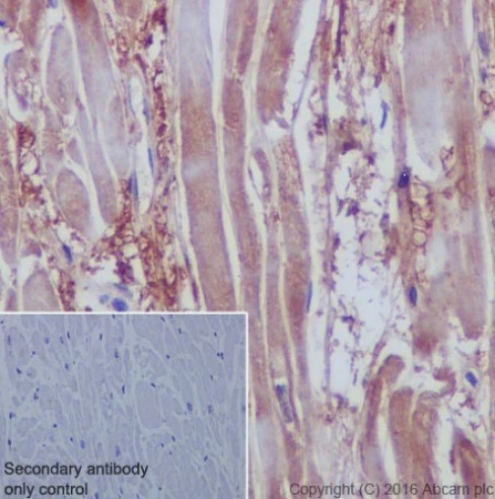АНТИТЕЛА МОНОКЛОНАЛЬНЫЕ КРОЛИЧЬИ RECOMBINANT ANTI-VEGFD [EPR8457], 100 МКЛ, ABCAM, AB155288