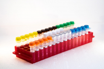 ТЕРМОЛАБИЛЬНАЯ УРАЦИЛ-ДНК-ГЛИКОЗИЛАЗА, 1000 Е.А.